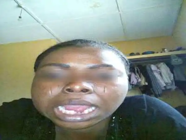 Photo: Male Corper Batters Female Corper In Abia, Removes Her Teeth With Hammer